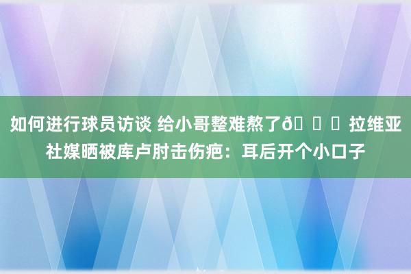 如何进行球员访谈 给小哥整难熬了😅拉维亚社媒晒被库卢肘击伤疤：耳后开个小口子